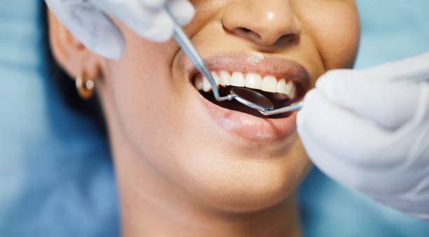 Best Emergency Tooth Extraction in Davison, MI
