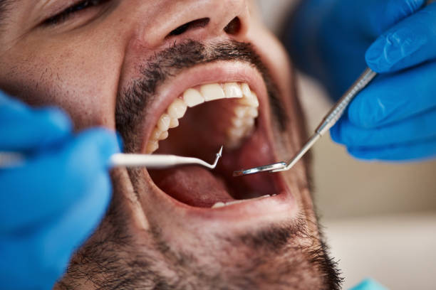 Best Emergency Broken Tooth Repair in Davison, MI
